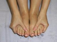 koude handen en voeten: veel voorkomende oorzaken en behandeling